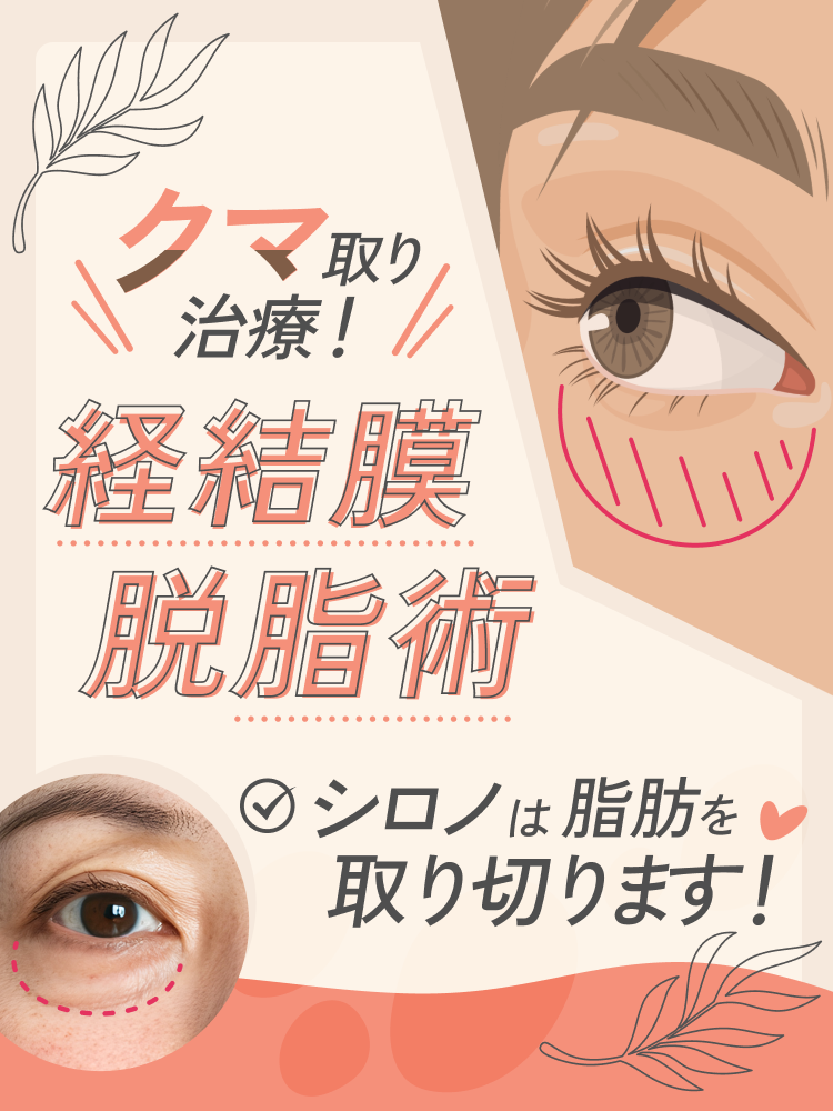 クマ取り治療！経結膜脱脂術